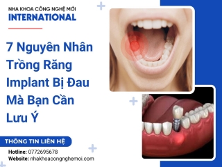 7 Nguyên Nhân Trồng Răng Implant Bị Đau Mà Bạn Cần Lưu Ý
