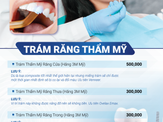 BẢNG GIÁ TRÁM RĂNG
