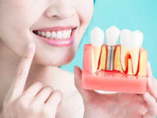 Yếu tố quyết định thành công của ca tiểu phẫu cấy ghép răng implant
