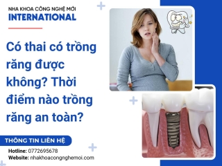 Có thai có trồng răng được không? Thời điểm nào trồng răng an toàn?