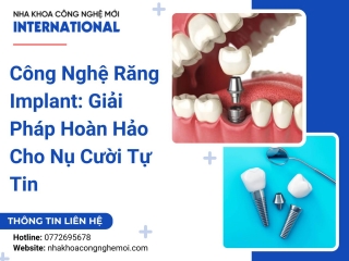 Công Nghệ Răng Implant: Giải Pháp Hoàn Hảo Cho Nụ Cười Tự Tin