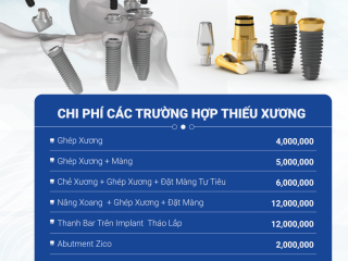 BẢNG GIÁ CẮM GHÉP IMPLANT