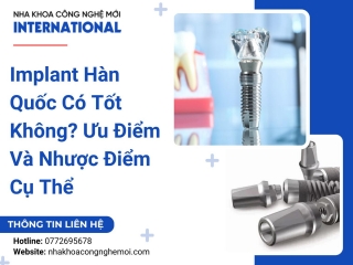 Implant Hàn Quốc Có Tốt Không? Ưu Điểm Và Nhược Điểm Cụ Thể