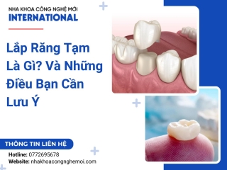 Lắp Răng Tạm Là Gì? Và Những Điều Bạn Cần Lưu Ý