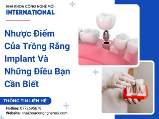 Nhược Điểm Của Trồng Răng Implant Và Những Điều Bạn Cần Biết