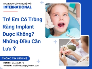 Trẻ Em Có Trồng Răng Implant Được Không? Những Điều Cần Lưu Ý