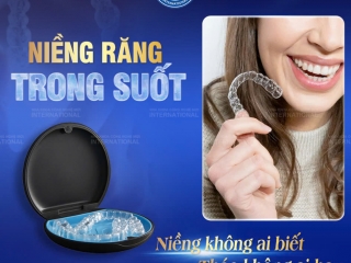 Tự Tin Niềng Răng Không Cần Che Giấu, Niềng Răng Trong Suốt Chính Là Chân Ái