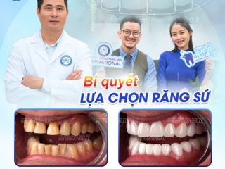 BÍ QUYẾT CHỌN RĂNG SỨ ĐẸP VÀ TỰ NHIÊN