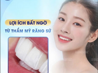 RĂNG SỨ : VẺ ĐẸP THẨM MỸ & ĐỘ BỀN VƯỢT TRỘI