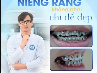 NIỀNG RĂNG - HƠN CẢ MỘT NỤ CƯỜI