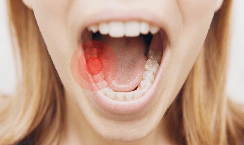 Trồng răng Implant bị đau có sao không?