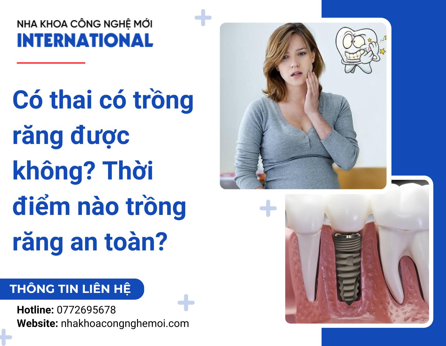 Có thai có trồng răng được không? Thời điểm nào trồng răng an toàn?
