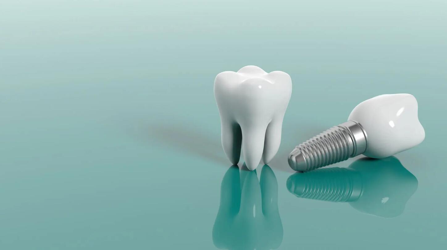 Cần lưu ý gì khi trồng răng tại phòng khám nha khoa Vũng Tàu