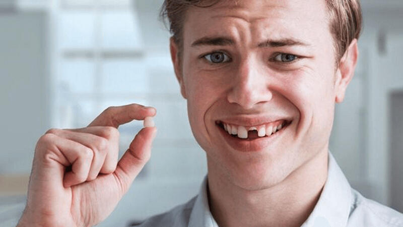 Mất răng lâu năm thường để lại những hậu quả nghiêm trọng gì?