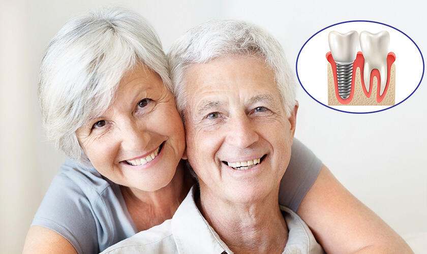 Điều kiện trồng răng implant ở người già