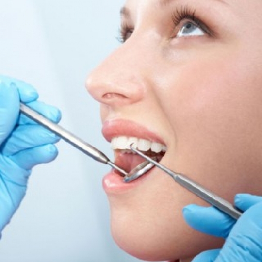 TRÁM RĂNG THẨM MỸ